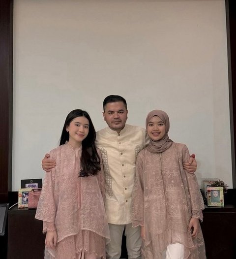 Setelah menikah dengan Haldy Sabri, dua putri sambung Irish Bella yang kini berstatus sebagai mahasiswa Kedokteran turut menarik perhatian publik.