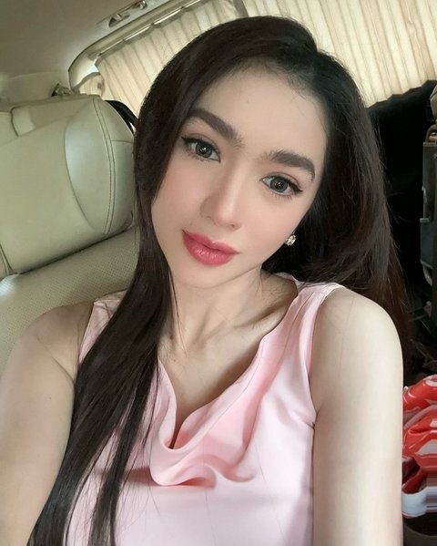 Angel Karamoy Dipuji Semakin Cantik Setelah Operasi Plastik di Korea, Dengan Bentuk Hidung yang Terlihat Berbeda