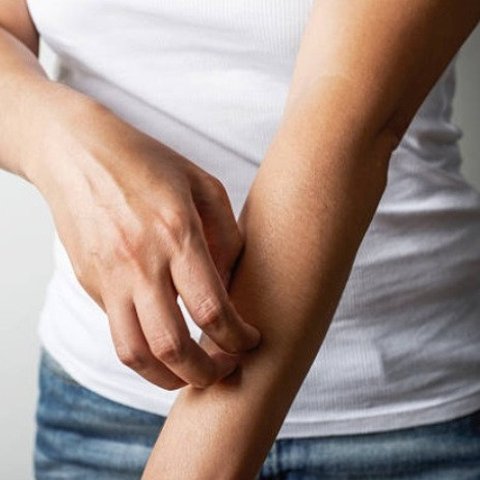 ilustrasi kulit gatal (istockphoto)