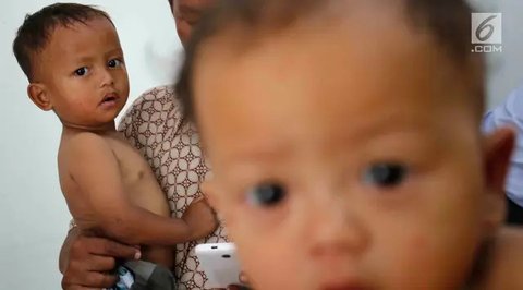 Dinkes Kota Tangerang melakukan intervensi serentak pencegahan stunting dalam Gerakan Serentak untuk Anak Tangerang Sehat dan Cerdas (Gertak Tangkas) di 1.097 posyandu.