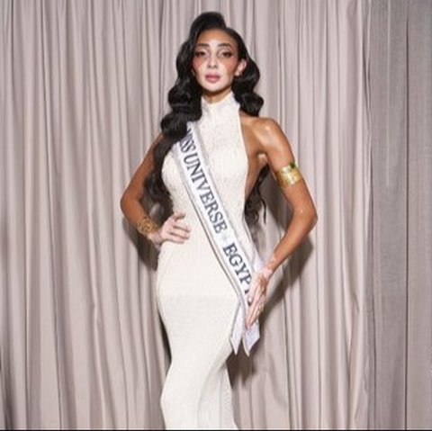 7 Potret Cantik dan Inspiratif Logina Salah, Peserta Miss Universe Pertama yang Mengidap Vitiligo