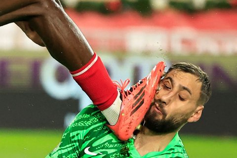 FOTO: Ngeri! Begini Kondisi Wajah Donnarumma Berdarah-darah Usai Tendangan Horor Wilfried Singo