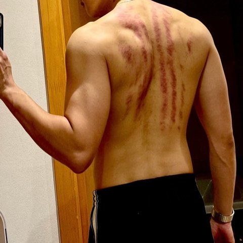 Ahn Bo Hyun