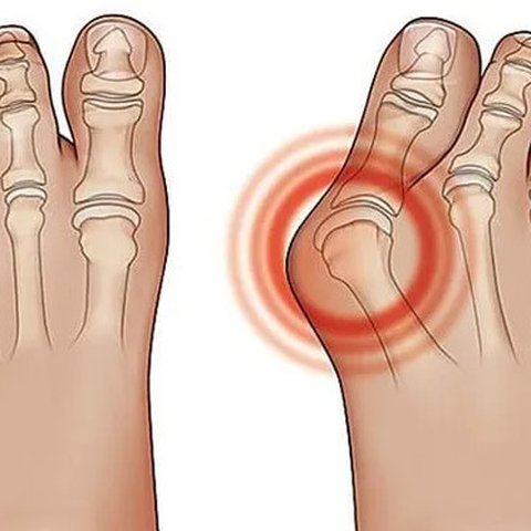 10 Sayuran yang Aman Dikonsumsi Penderita Asam Urat, Awas Jangan Salah Santap