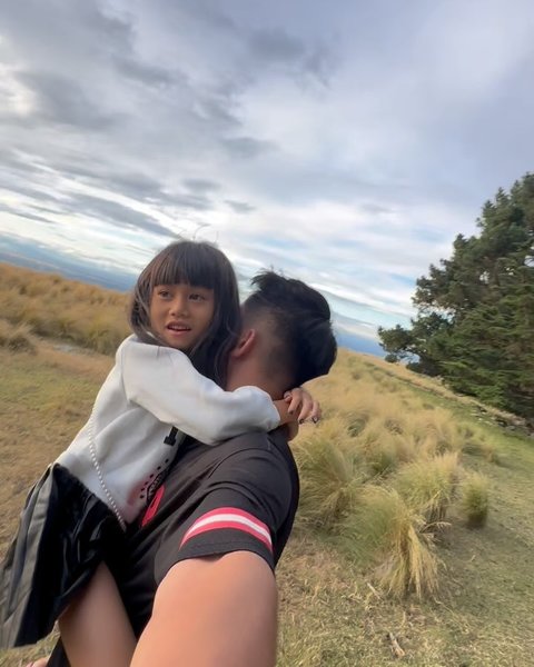 Boy William Kena Ulti Keponakan, Disebut Punya Hidung Palsu