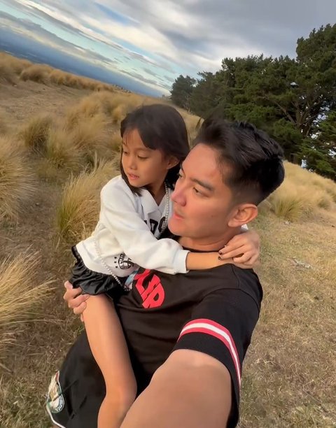 Boy William Kena Ulti Keponakan, Disebut Punya Hidung Palsu