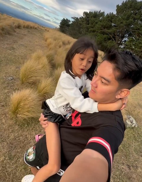 Boy William Kena Ulti Keponakan, Disebut Punya Hidung Palsu