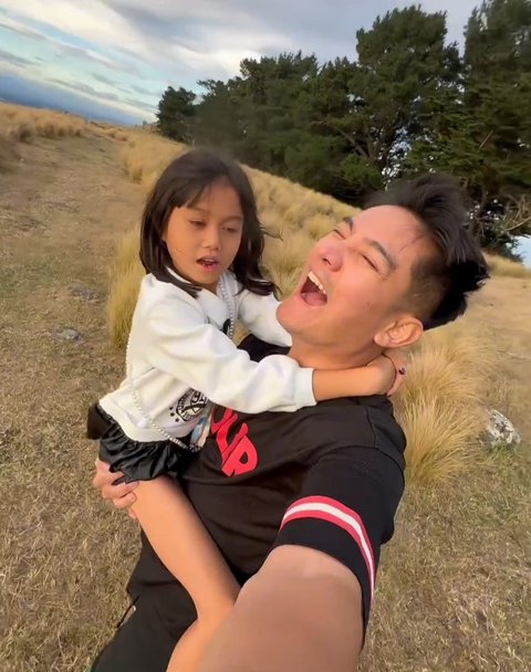 Boy William Kena Ulti Keponakan, Disebut Punya Hidung Palsu