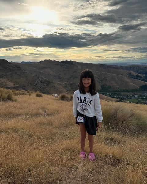 Boy William Kena Ulti Keponakan, Disebut Punya Hidung Palsu