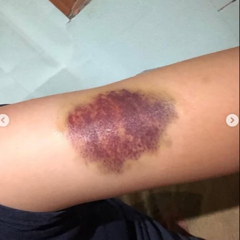 wanita dianiaya polisi polda jabar