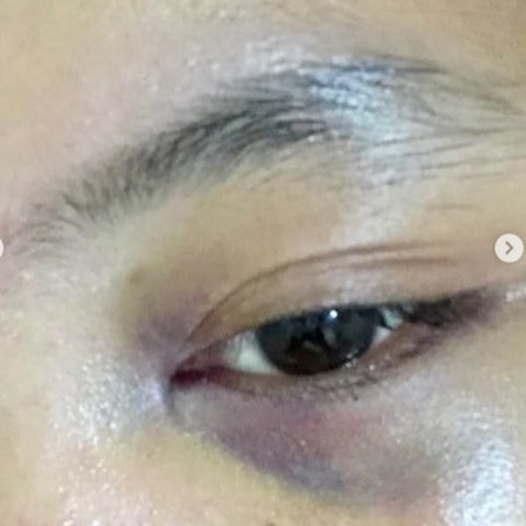 wanita dianiaya polisi polda jabar