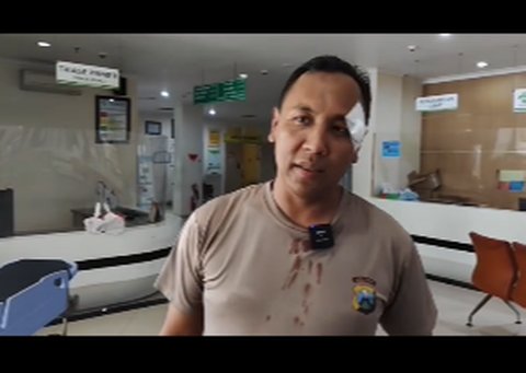 Kondisi Ipda Purnomo Polisi Baik Dipukul ODGJ Hingga Berdarah-darah