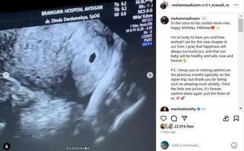 Penampakan Tora Sudiro dan Anggraini Kadiman berdampingan dianggap  momen langka. Kekompakan mereka demi anak pun sukses menuai pujian dari warganet.  [@t_orasudi_ro].