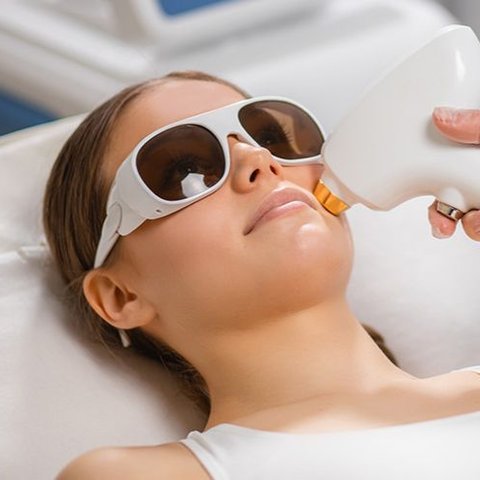 Hair removal laser
