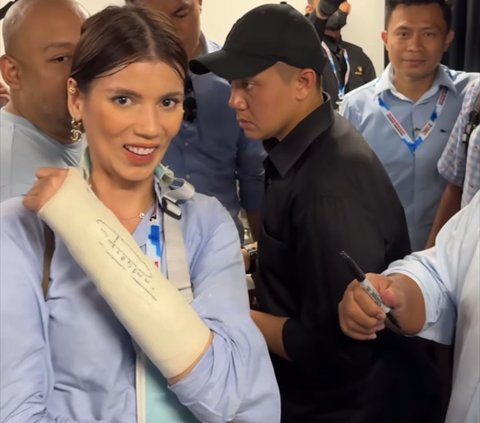 Cerita Sabrina Istri Deddy Corbuzier Tangannya di Gips, Mau Ditandatangani Prabowo