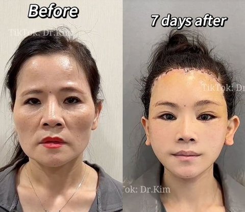 Controversial Transformation Portraits of Dr. Kim, Viral Plastic Surgeon on TikTok