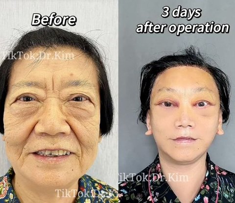 Controversial Transformation Portraits of Dr. Kim, Viral Plastic Surgeon on TikTok