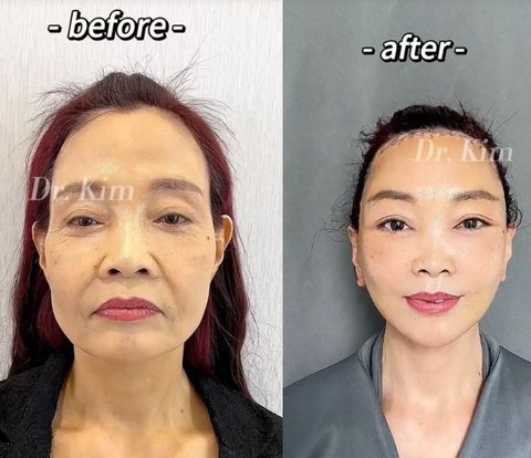 Controversial Transformation Portraits of Dr. Kim, Viral Plastic Surgeon on TikTok