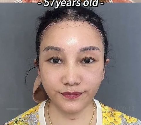 Controversial Transformation Portraits of Dr. Kim, Viral Plastic Surgeon on TikTok