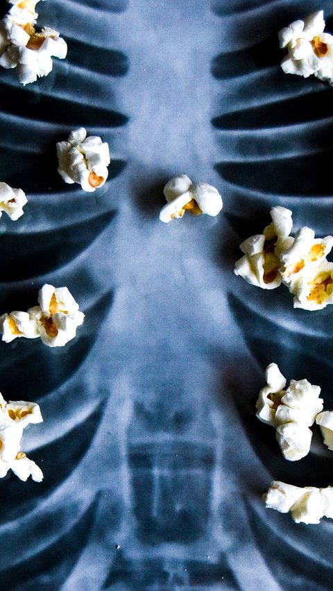 Mengenal Popcorn Lung, Gangguan Pernapasan karena Zat Kimia<br>