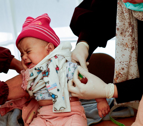 FOTO: Potret Anak-Anak Palestina Menderita Kekurangan Gizi di Pengungsian Rafah, Gaza Selatan