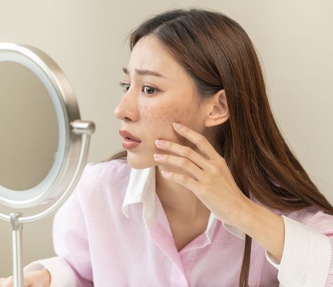 3 Cara Samarkan Flek dengan Skincare, Ada Triknya