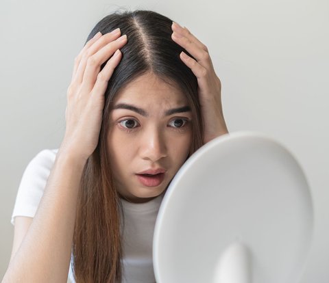Oily Hair? Don't Worry, There Are 5 Ways to Overcome It