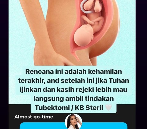 Pesona Bumil Kian Terpancar, Potret Terbaru Sheila Marcia Hamil Anak Kelima, Jelang Persalinan Sering Alami Kontraksi Palsu