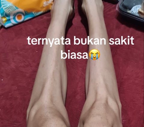 Kisah Haru Pria Mengenang Mendiang Istri Tercinta, Tetap Perhatikan Makan Suami Meski sedang Sakit