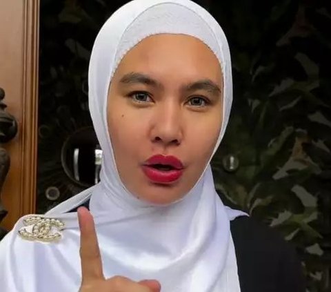 Face Blistered, Latest Portrait of Kartika Putri who Suffers from Steven Johnson Syndrome.