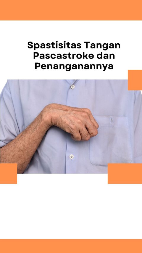 Spastisitas Tangan Pascastroke dan Penanganannya