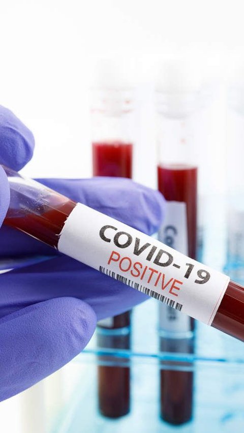 <b>Sejarah 2 Maret: Kasus Pertama Virus Covid-19 di Indonesia</b>