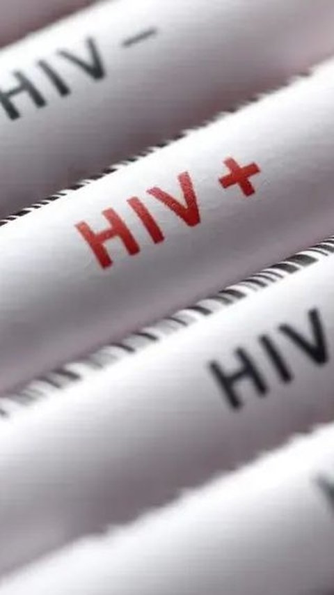 Bagaimana HIV Bisa Menular?