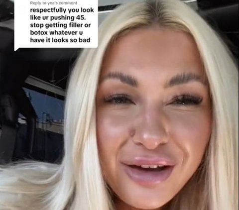 Addicted to Fillers and Botox, This Girl is Shocked That Her Skin is Wrinkled Instead, Thought to be 45 Years Old at the Age of 22