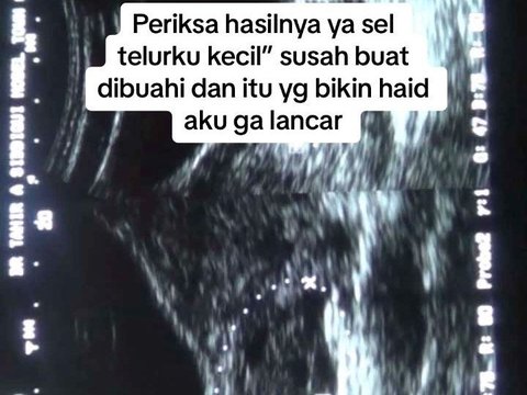 14 Tahun Menanti, Perjuangan Sepasang Suami Istri untuk Punya Buah Hati Ini Berakhir Manis