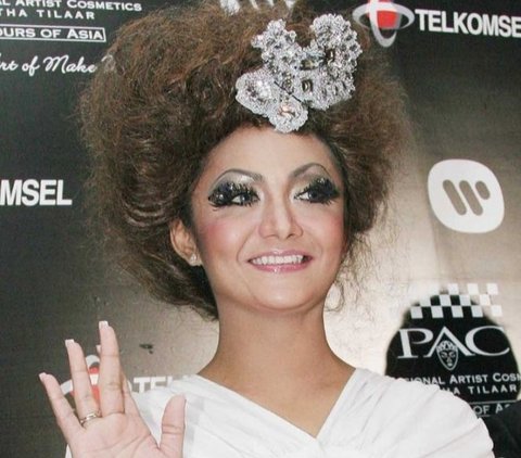 Seperti kakaknya, Krisdayanti juga tampaknya melakukan prosedur veneer gigi untuk mendapatkan gigi yang lebih rapi dan putih.