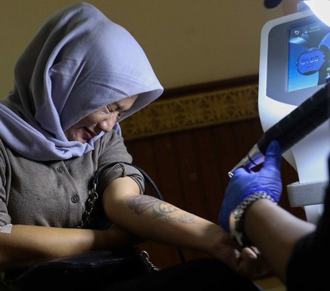 FOTO: Antusiasme Puluhan Peserta Ikuti Layanan Hapus Tato Gratis Saat Ramadan