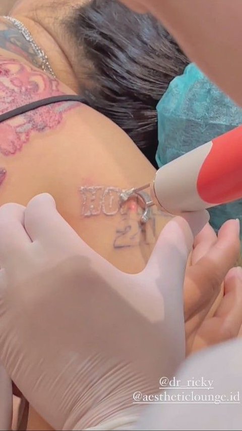 Nikita Mirzani uploaded a moment of removing the tattoo on Instagram.