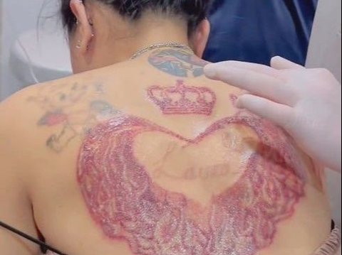 Heartbroken, Nikita Mirzani Removes Tattoo of Lolly's Name on Her Back