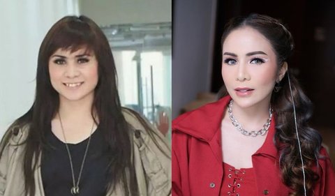 siapa saja artis yang menjalani prosedur filler bibir ini? Simak ulasannya berikut ini: