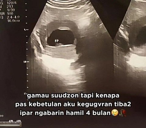 Sad Story of a Pregnant Woman Whose Belly Suddenly Deflates at 4 Months Gestation, Strangely Her Sister-in-Law Suddenly Becomes 4 Months Pregnant