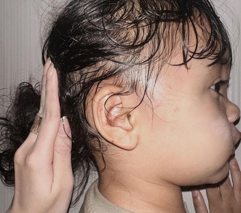 Babysitter yang Aniaya Anak Selebgram Aghnia Ditetapkan Tersangka