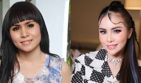 Momo, mantan personel Geisha, juga memiliki gigi gingsul sebelumnya. 