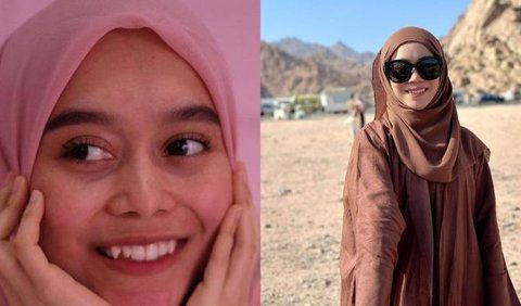 Lesti Kejora juga memutuskan untuk menghilangkan gigi gingsulnya dengan menggunakan behel agar struktur giginya lebih rapi. 