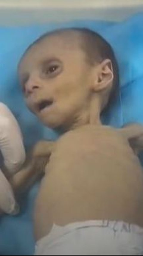 VIDEO Bayi 2 Bulan di Gaza Sekarat karena Kelaparan Akibat Blokade Israel Larang Masuk Bantuan Makanan
