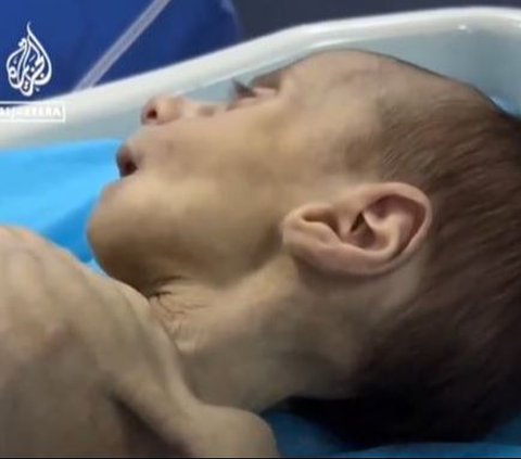 VIDEO Bayi 2 Bulan di Gaza Sekarat karena Kelaparan Akibat Blokade Israel Larang Masuk Bantuan Makanan