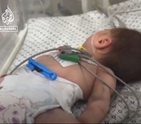 VIDEO Bayi 2 Bulan di Gaza Sekarat karena Kelaparan Akibat Blokade Israel Larang Masuk Bantuan Makanan