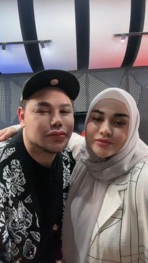 12 Artis Punya Wajah Mirip Artis Lain & Dibilang Kembar, Ada Aurel Hermansyah-Ivan Gunawan