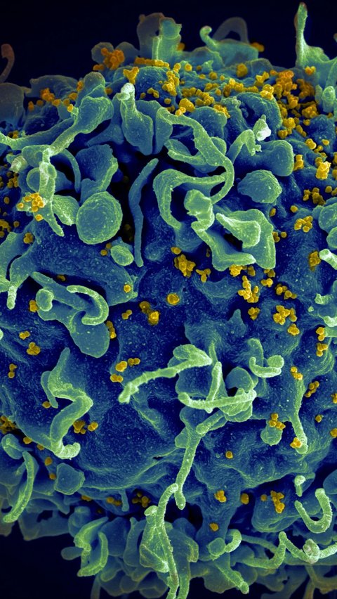 Memahami Siklus Hidup HIV