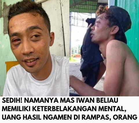 Tragis dan Memilukan, Pengamen Keterbelakangan Mental Dipukuli  dan Uangnya Dirampas Orang Tak Dikenal